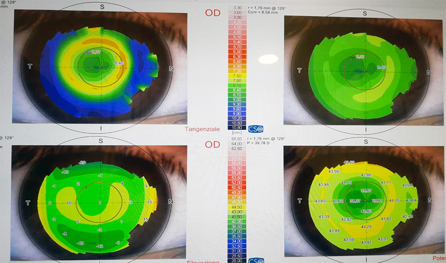 Ottica_Fantini_Servizi_TopografoCorneale_02